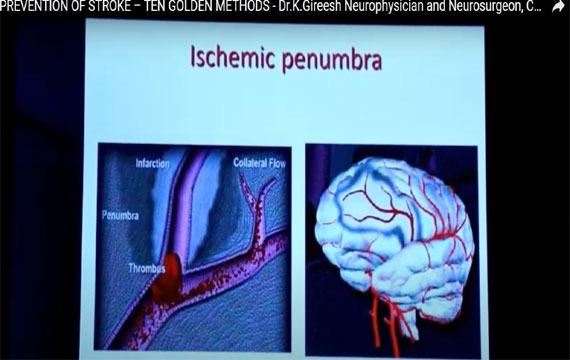 Padma Clinic Medical Videos